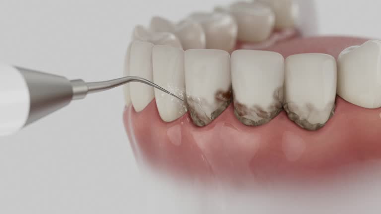 Reliable Dental Implants contractor in Olney, IL by Smile Center Dentistry